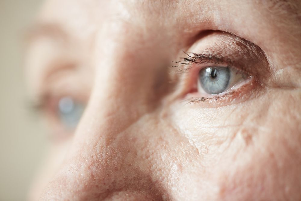 epiretinal-membrane-macular-edema