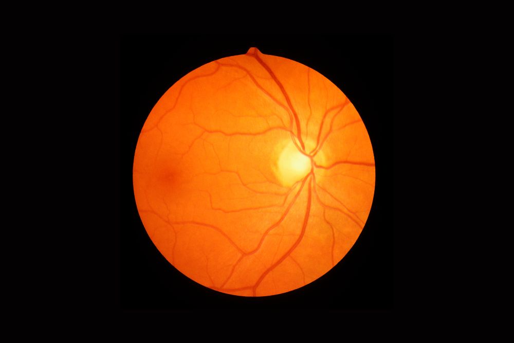 retina-veins-and-cardiovascular-health