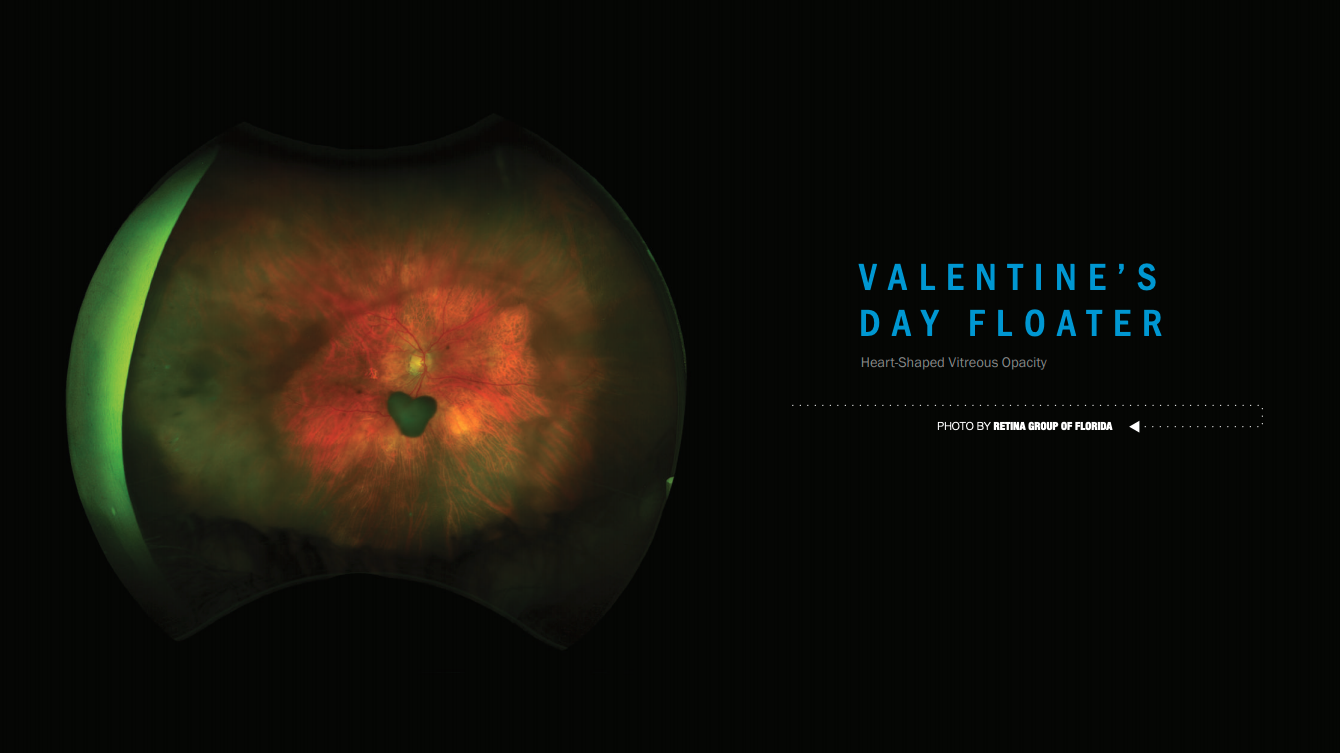 Valentines Day Floater